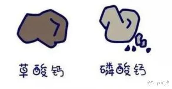 水果|尿路结石患者为什么要多吃蔬菜水果和粗纤维食物？