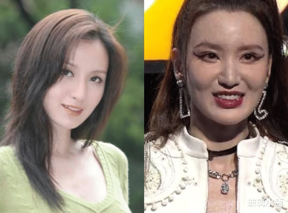 整容|嘴歪脸肿，一做表情就“尴尬”，实力派女明星也被“整容脸”拖累