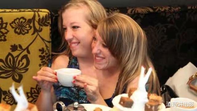 中国科学院|世界上真实存在的双头人，姐妹共用一个身体，却分别控制半边身体