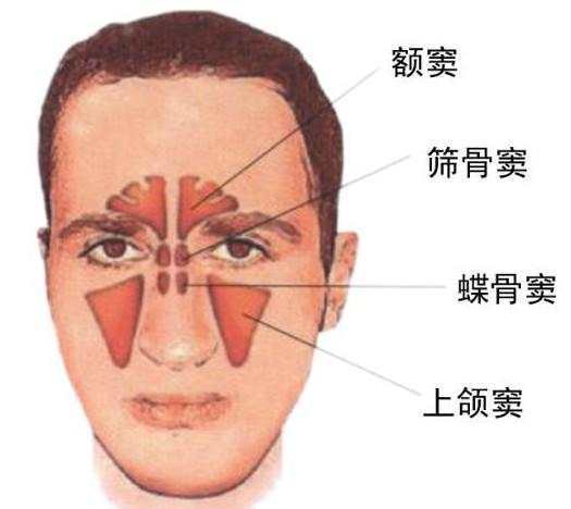 金魁九香油|金魁九香油科普：为何鼻窦炎患者鼻涕会倒流喉咙
