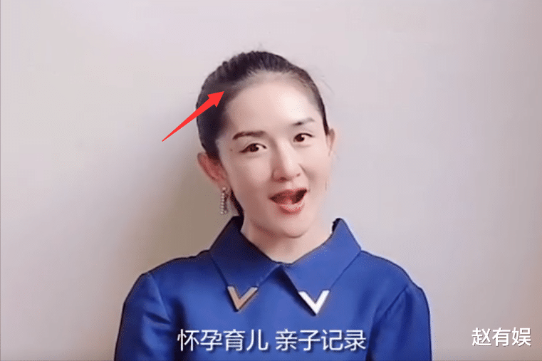 闫学晶|谢娜素颜出镜惹争议！回看圈中过往，已有多位明星宝妈被吐槽