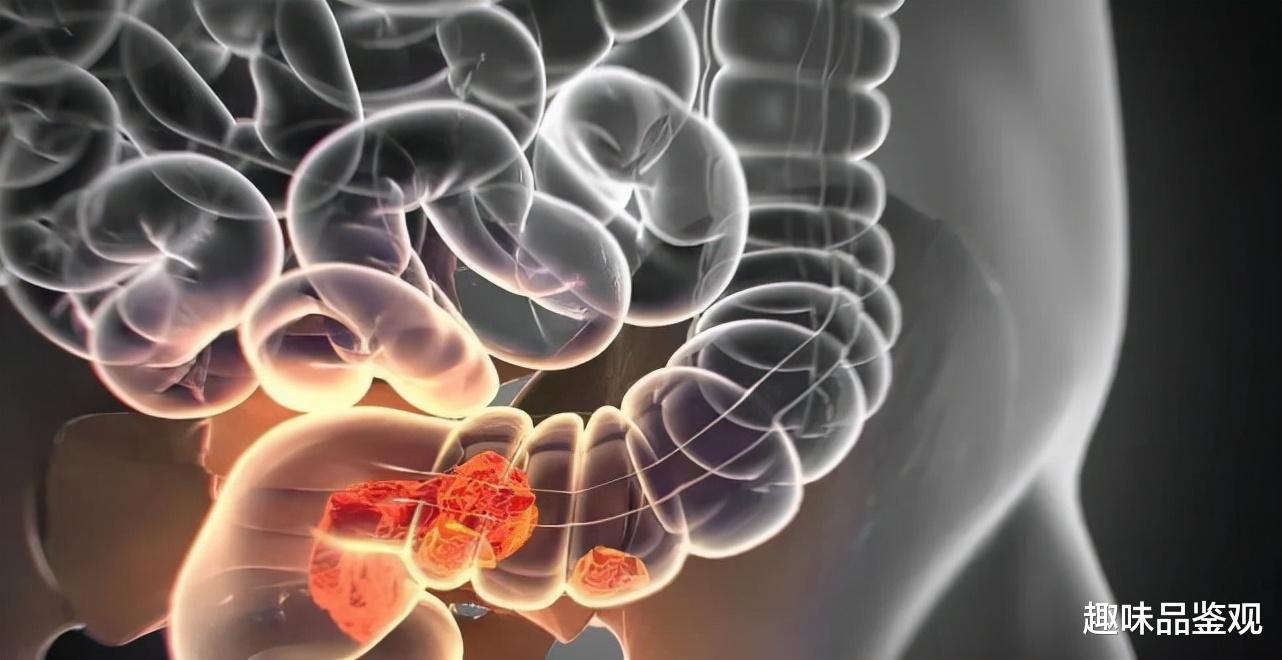 肝损伤|吃糖让人少活20年？荷兰小伙科学戒糖，1个月后整个人都变了