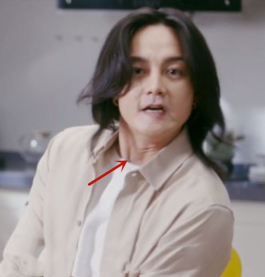 发际线|尹正减肥后发际线堪忧，皮肤松弛，被网友吐槽34岁看着像五十