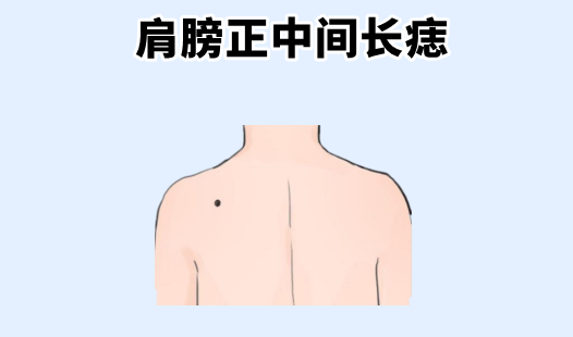 中国易经风水|身上4颗“破财”痣，频频漏财，花钱大手，存不住钱，买不起房！
