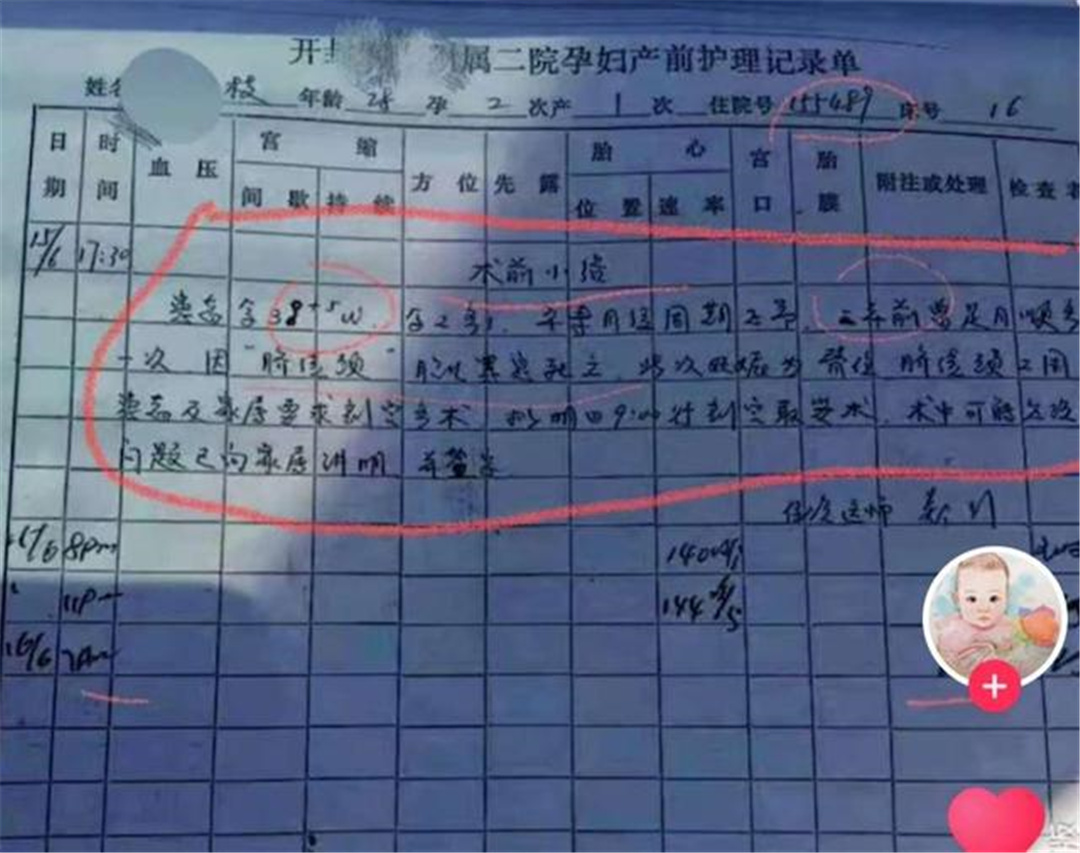 杜新枝 杜新枝产前护理单曝光，姚策一周胎位变动大，许敏住院后她就换了床位