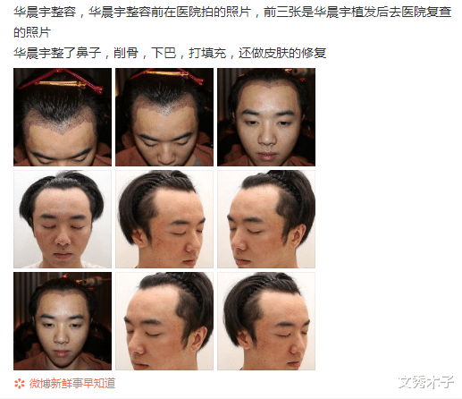 文秀木子|张碧晨被爆是三:插足别人感情的女人,最终都没什么好下场