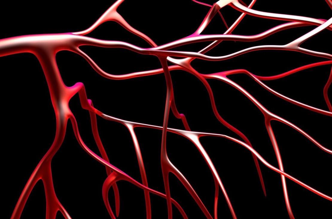 饮食|这3物，是血管清理工，每天坚持吃，血管更健康