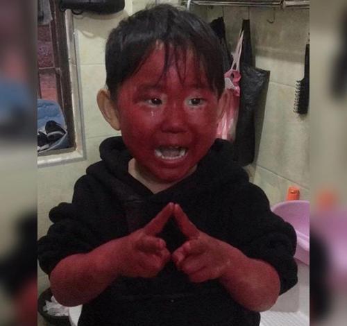 舜网 妈妈出门留女儿自己在家，回来看到女儿身上“血淋淋”的，差点报了警