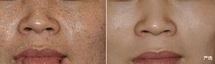 杨超越|俞飞鸿49岁的素颜照，皮肤白嫩毫无槽点，一点也没老年脸的松垮感