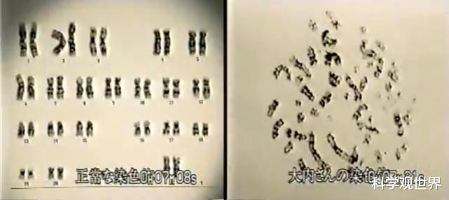 行星 一次核事故让他全身DNA破裂，最终看着自己的身体逐渐腐烂