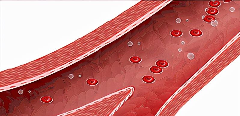 胆固醇|血脂包含什么?血脂、胆固醇和甘油三酯,到底谁是祸首?