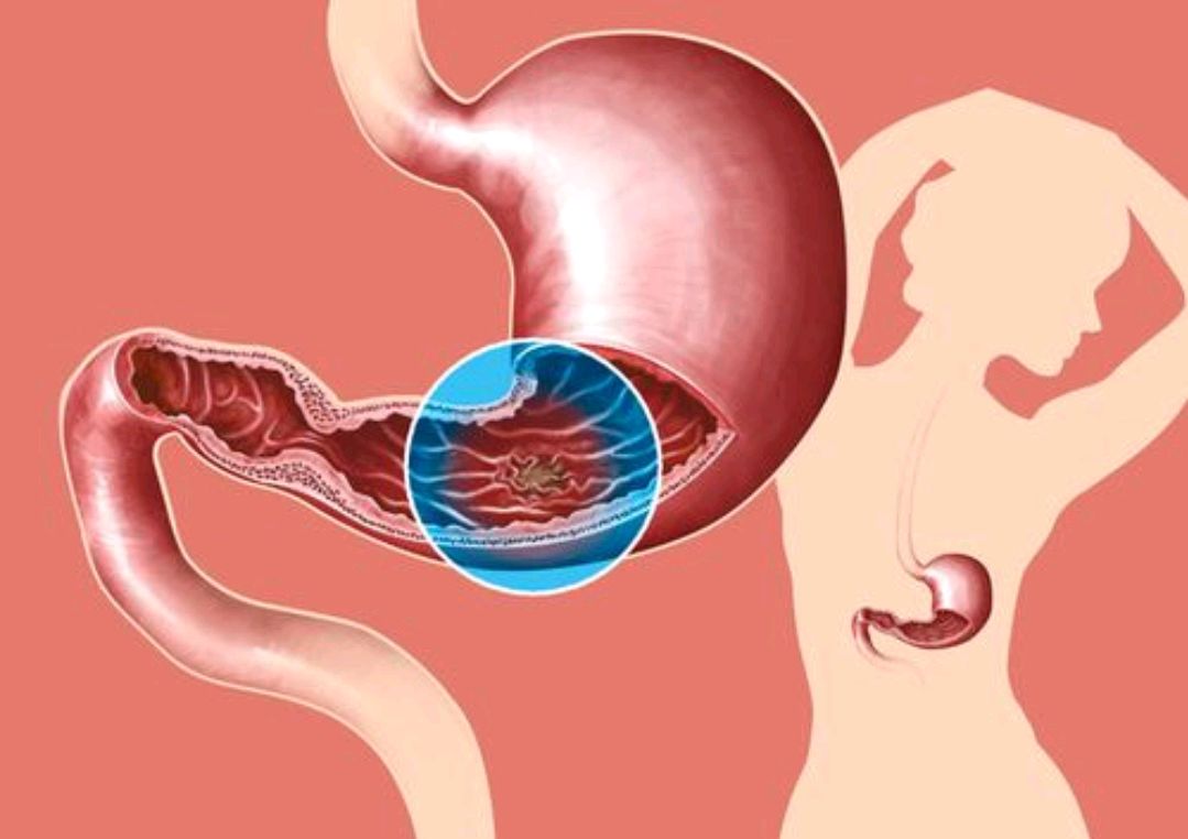 脾胃|想要健脾养胃，饮食调理是关键，多吃1类食物常喝1水，帮助补脾胃