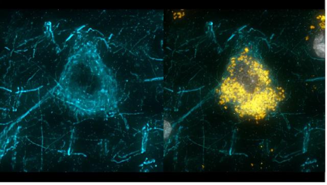 巨蜥 美国“脑计划”取得重大进展，从小鼠到猴子再到人类
