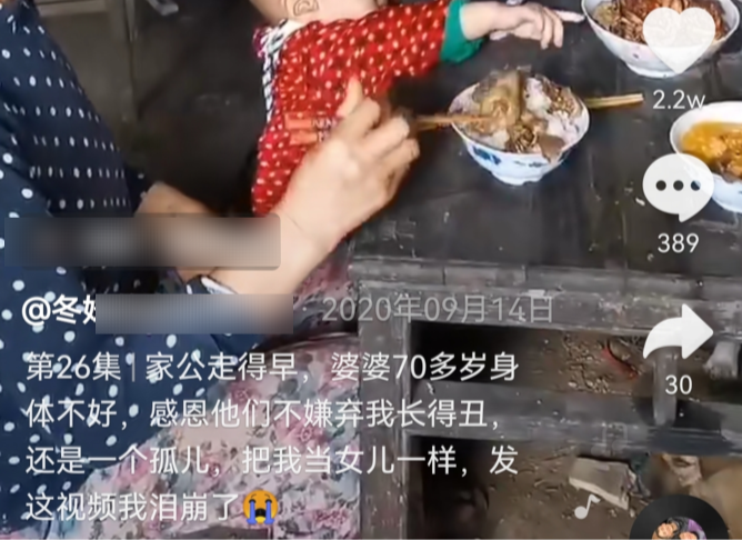 育儿宝屋|我有遗传病但坚持生了五胎：一个白化病、一个唇腭裂、一个精神病