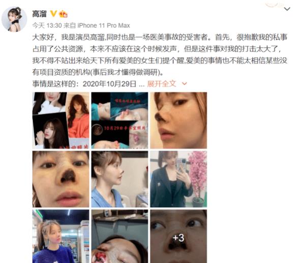 Angelababy|杨颖接受惩罚落入水中，抬头时鼻子却突然“变形”，救场都晚了