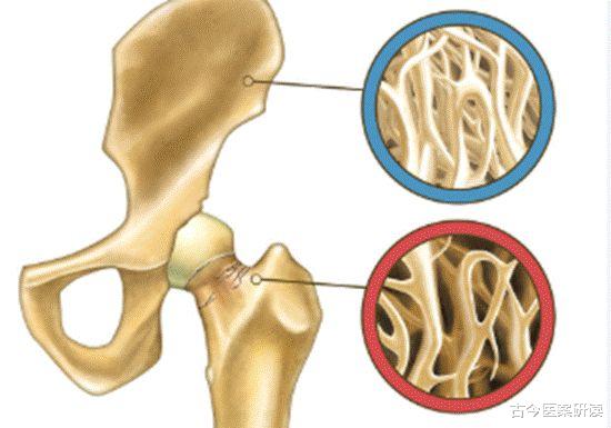 |养骨“冠军”被发现，不是牛奶虾皮，医生：敞开吃，骨骼或比钢筋还硬