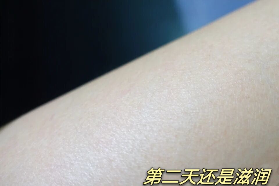 保湿 美白保湿淡鸡皮看这里！6款火爆全网的孕期身体乳，安全好用不踩