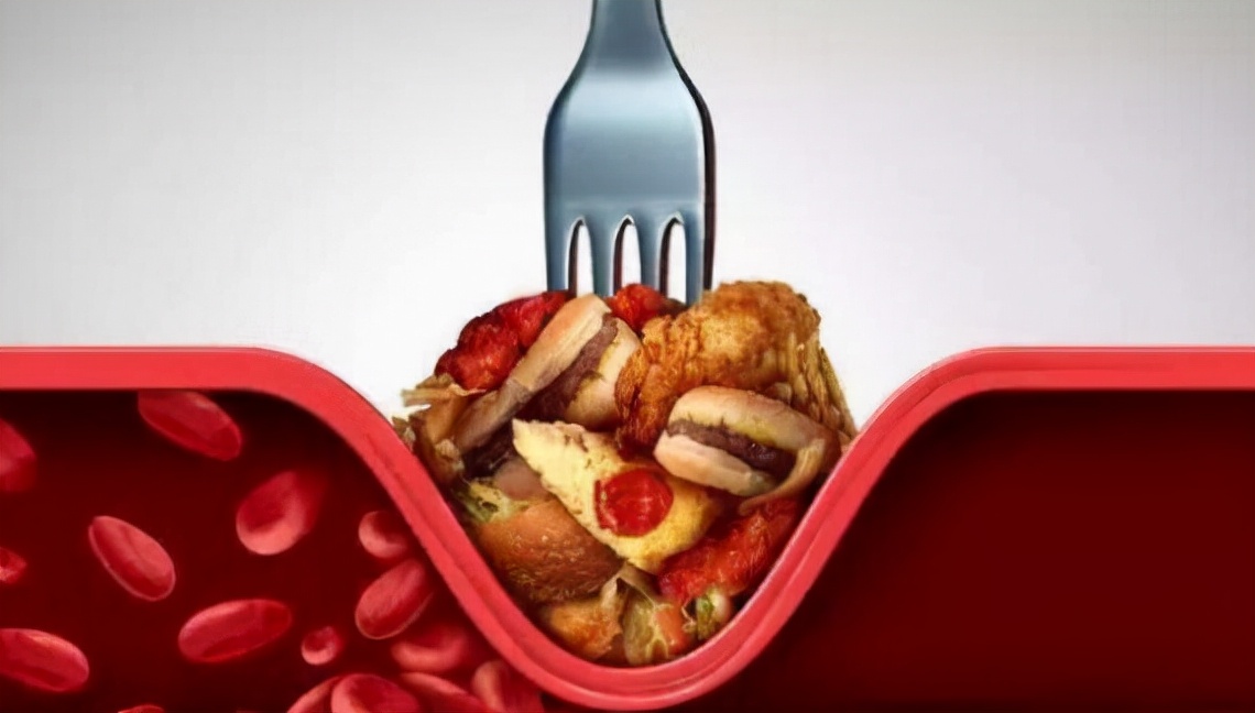 胆固醇|胆固醇高不能吃豆腐？医生：这3样素食也别吃，血管会“扛不住”