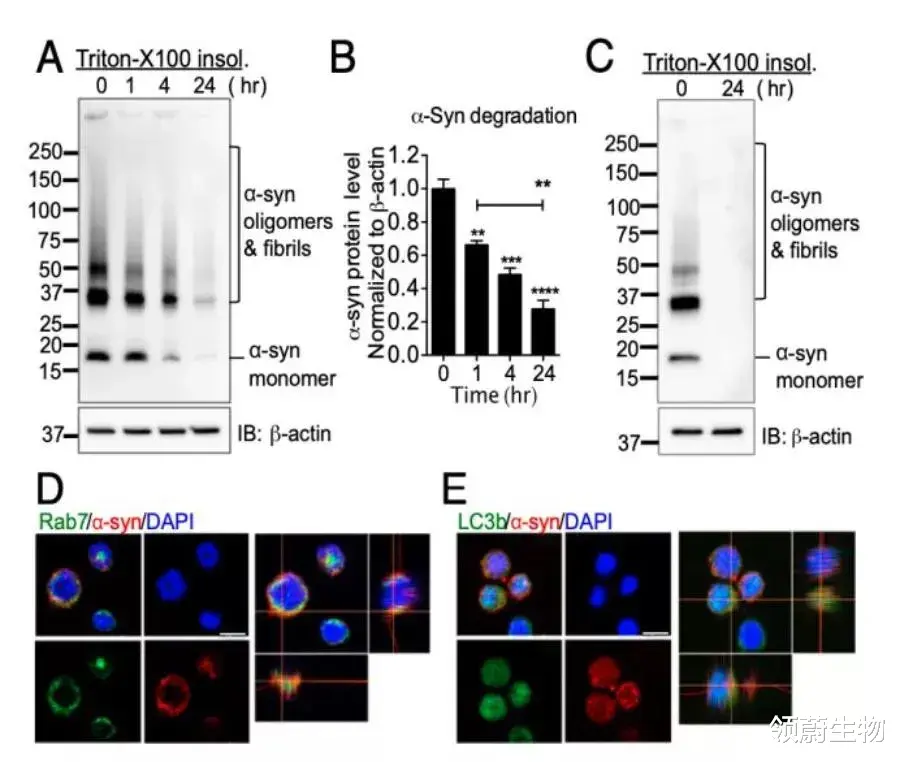 《PNAS》重磅:NK细胞不但能防癌,还能阻止帕金森病恶化