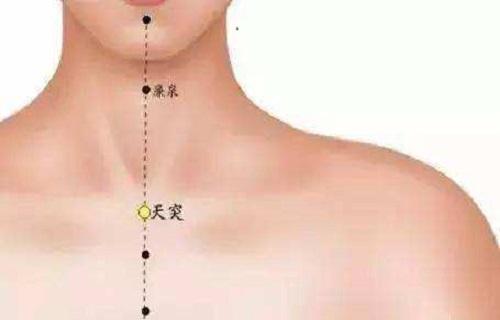 香艾儿 痰和湿不一样！黄痰、白痰...?试试艾灸这6穴