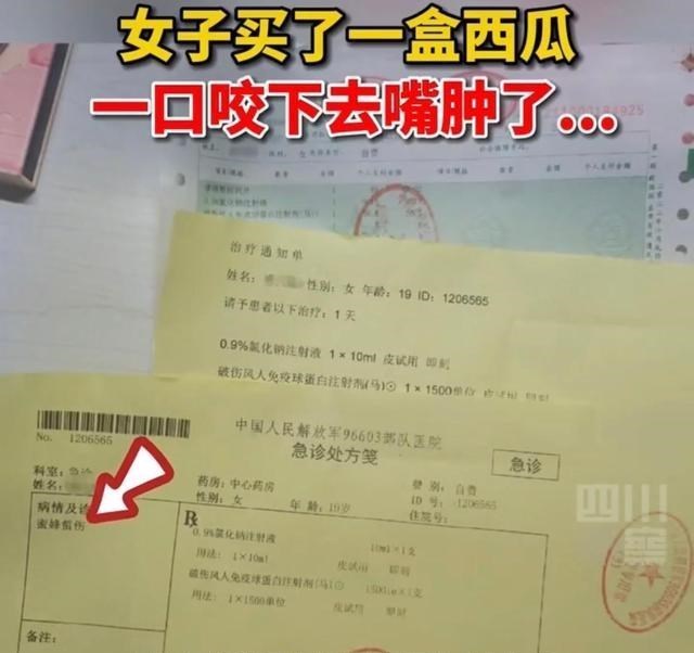 湖南怀化：女子买了一盒西瓜，一口咬下去居然嘴肿了！