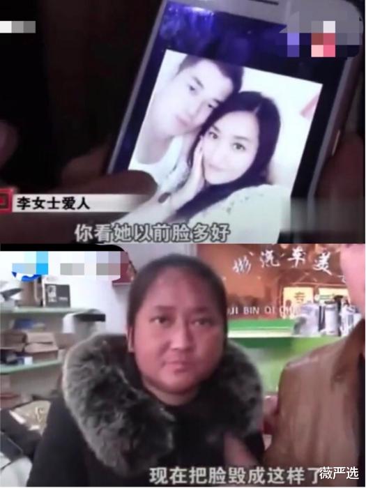 |丈夫：一夜之间你的脸怎么黑了？女子的美貌消失了，美白还需谨慎