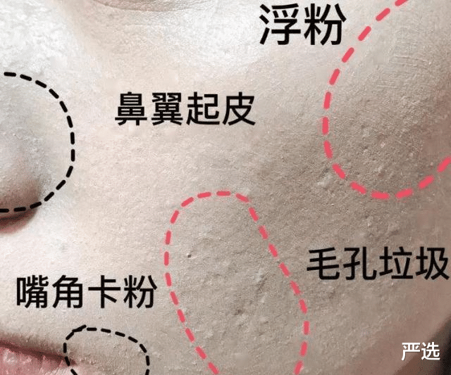 护肤品 43岁李小冉素颜出镜，肌肤状态精致到毛孔，闭口痘痘都没有