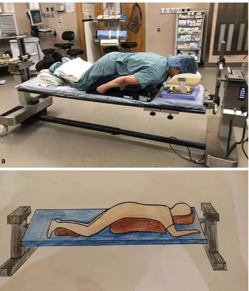 青菜|给大家介绍一种新的手术体位摆放方法