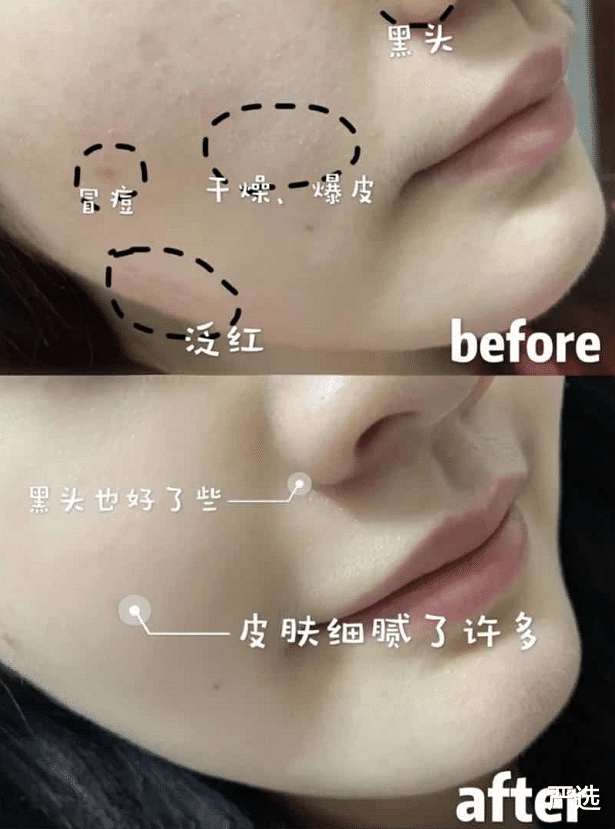 严选|李佳琦晒的驻颜精华，价格便宜不输大牌，张嘉倪：能抗氧化缓衰老