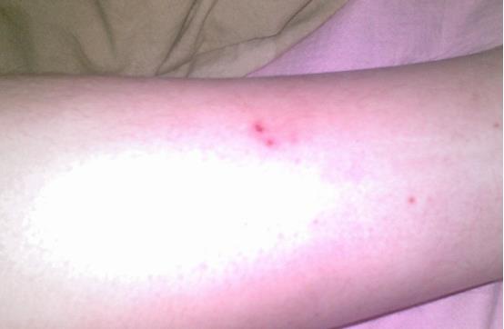 蜈蚣 30厘米长的蜈蚣你见过吗?澳洲小岛上还真有,每年吃掉3000只海鸟