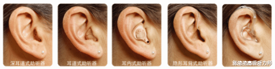 张艳艳高级听力师|助听器换机后还需要适应?借口还是真相?业内人士为你揭晓