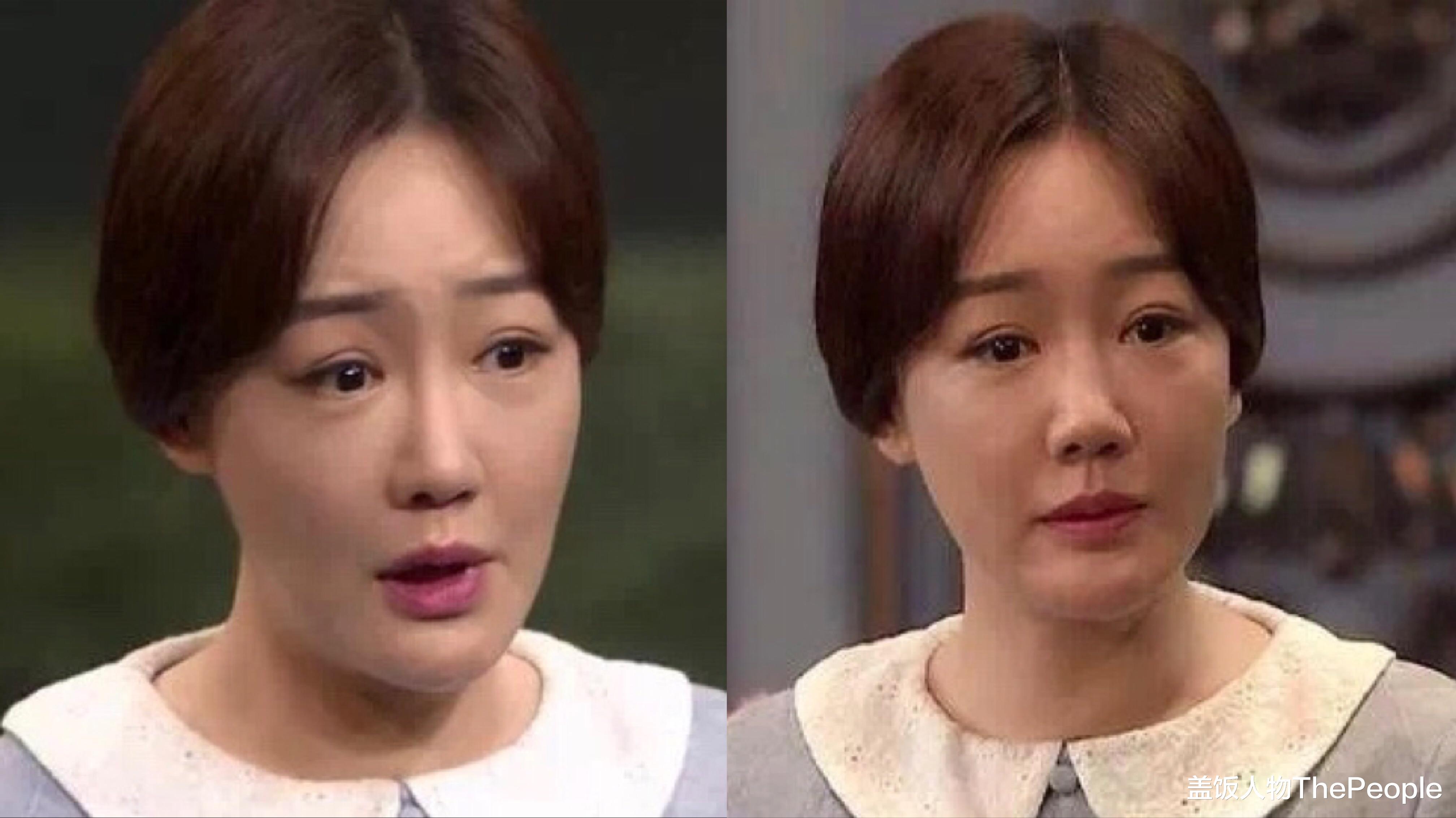 张萌|嘴歪、脸肿、表情僵硬，让实力派女星们陷入“中年危机”，太可惜