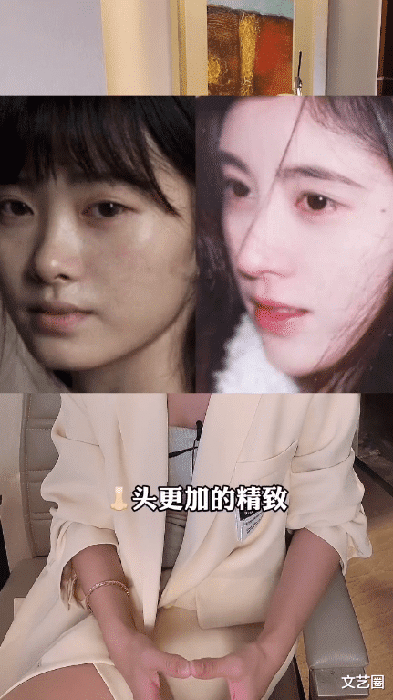 鞠婧祎|网红整容痕迹明显却吐槽鞠婧祎有整容后遗症，被网友打脸后坦言：我动过全脸