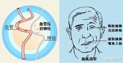 健康辨证说|眼皮跳，嘴角抽，脸上的肉为什么如此调皮？中医：可能是肝有了情绪！