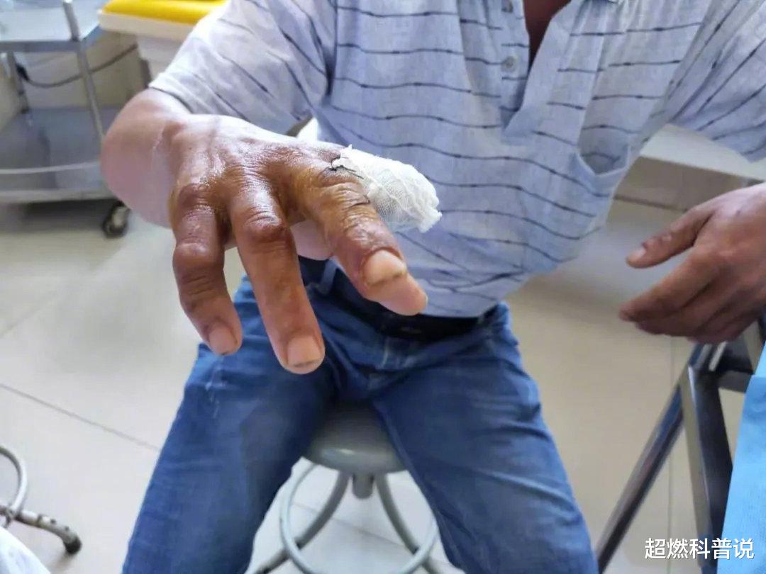 永州 毒蛇被泡在酒坛里一年了，打开后却还能复活咬人，蛇为何还没死？