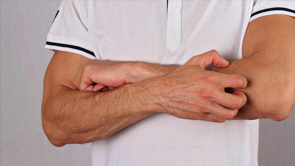 皮肤瘙痒|肾功不好的男人，身上会有5个特征，若能1个不占，很棒