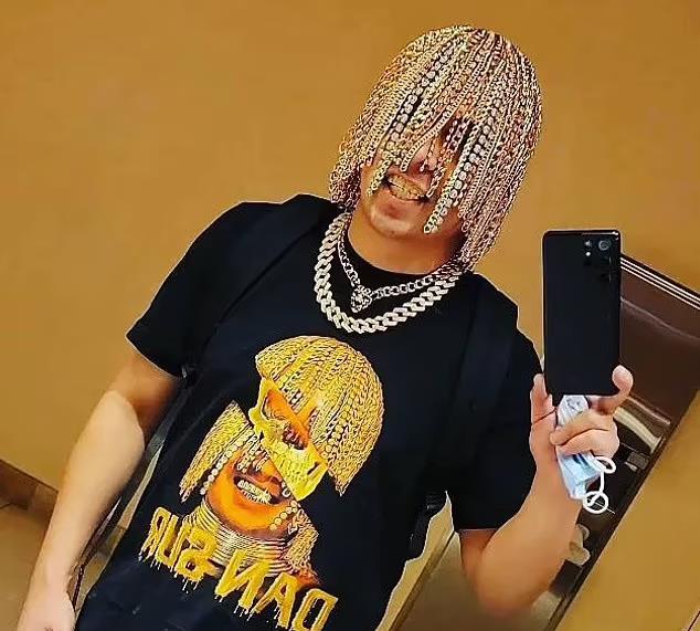 医生|脑门镶钻后，又有歌手钻开头骨植满大金链？网友嘲翻！