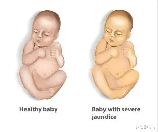 我是懒妈妈|新生儿6种看似奇怪其实正常的现象,顺其自然就好,无需过度关心