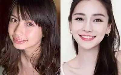 郭德纲|女明星换牙堪比整容？前四位我认了，最后一位：谁信呢？