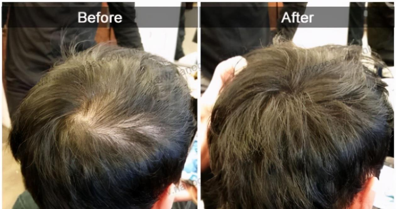 基因突变 科学家发现一只黑猩猩基因突变，差点变成人，与人类只差1.2％