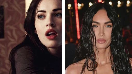 芒果台|昔日「美艳尤物」云端陨落——又一个被「整容」毁了的神颜美女