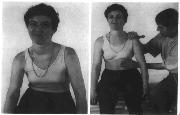 脑卒中|脑卒中肩关节半脱位的早期综合分析与康复治疗