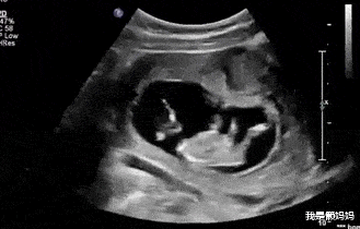 我是懒妈妈|为啥胎宝动的时候没有鼓包？孕妈别乱猜，很多时候是因为2个原因