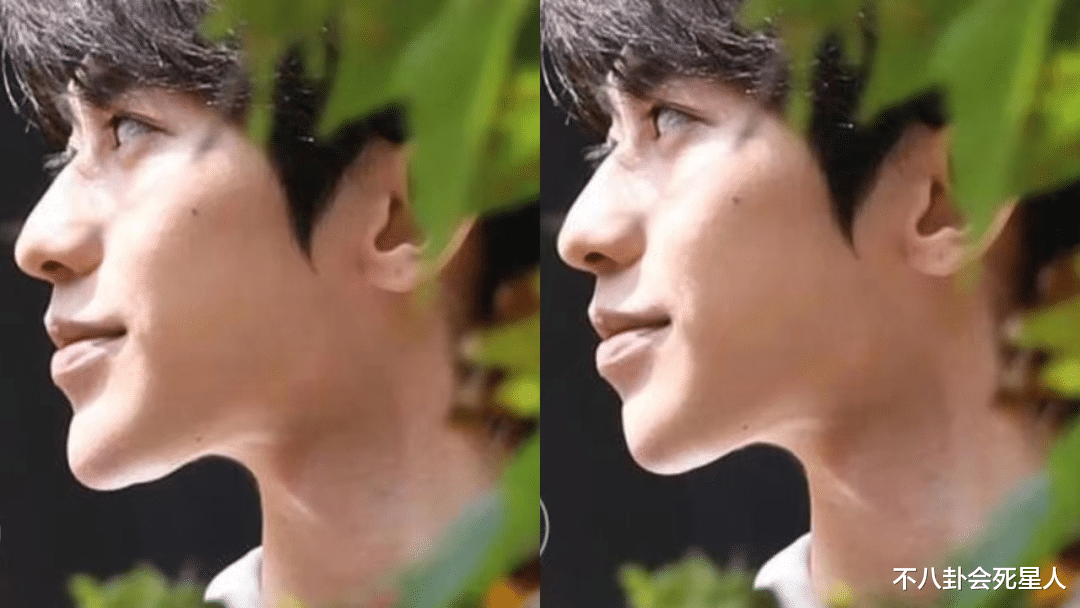 孙菲菲|明星动下巴千奇百怪，李小璐又尖又翘，孙菲菲不愿照镜子