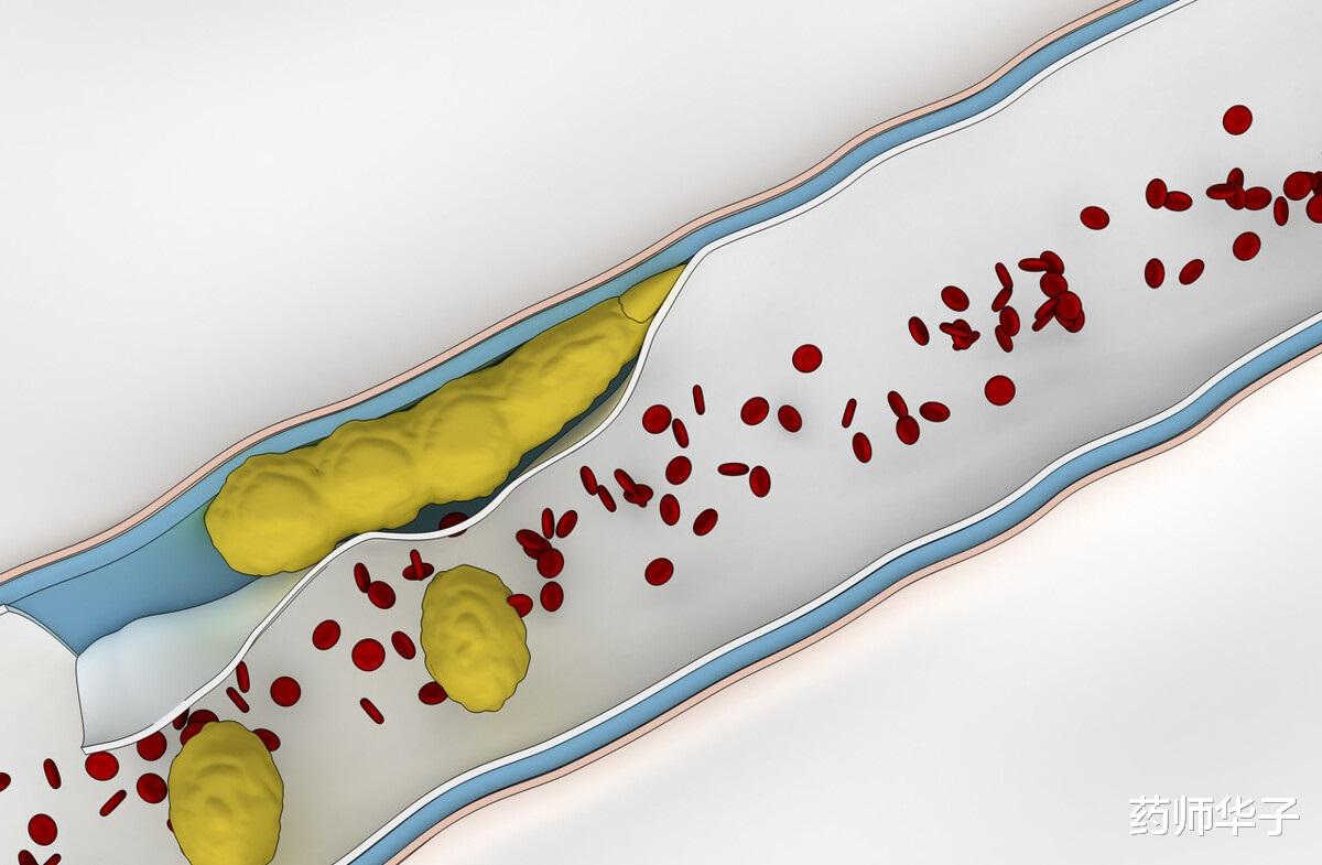 药师华子|为什么脚趾上的小伤会造成截肢？糖尿病足，预防比治疗更重要