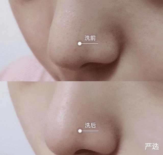 减肥药|“洗面奶”查出致癌物!你的日用款上黑名单了吗?