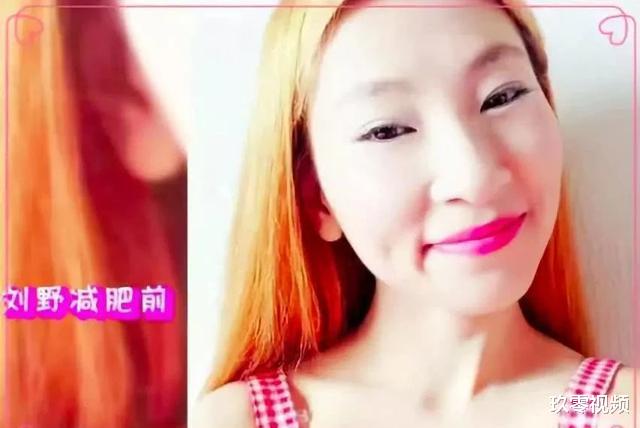 美甲|?她为爱从120斤瘦成58斤的骷髅，却吓跑了男友，如今怎样了？