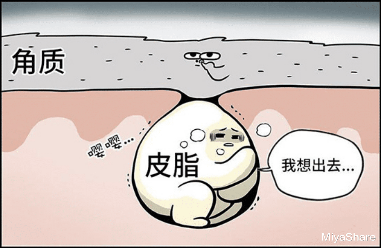穿衣搭配 青春期爆痘如何护肤？3个护肤要点请牢记！附产品推荐清单
