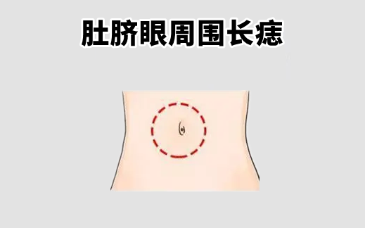 中国易经风水 “百里难挑的5颗痣”，个个不差钱，前半生富，后半生福！