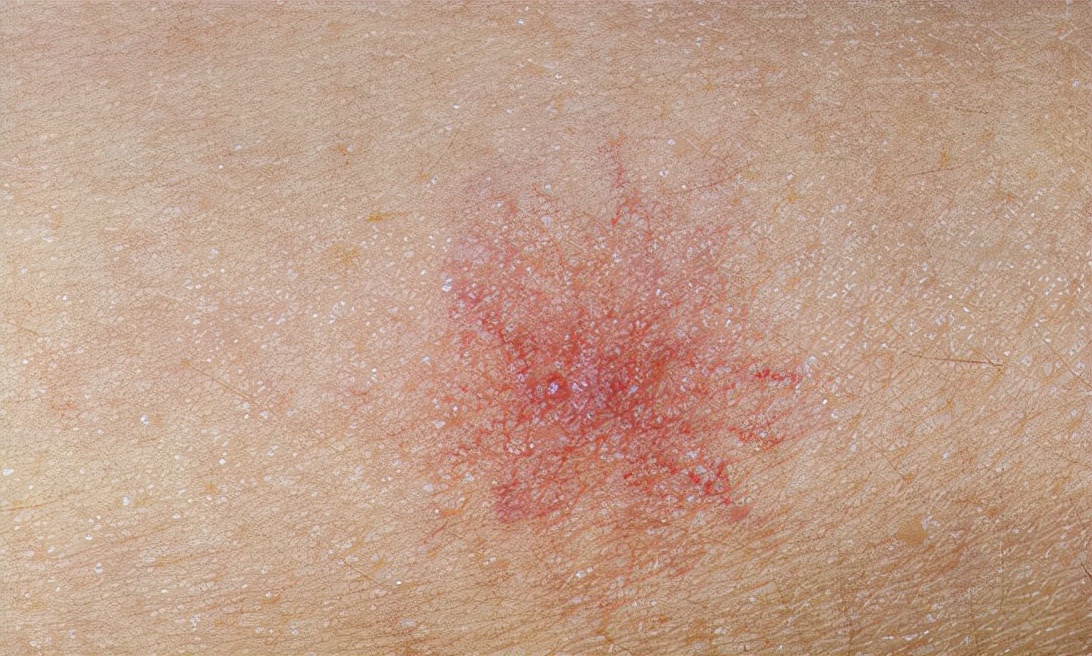 绿豆|解毒“高手”被发现，绿豆未上榜，若你爱吃，肝毒或能一天天排净